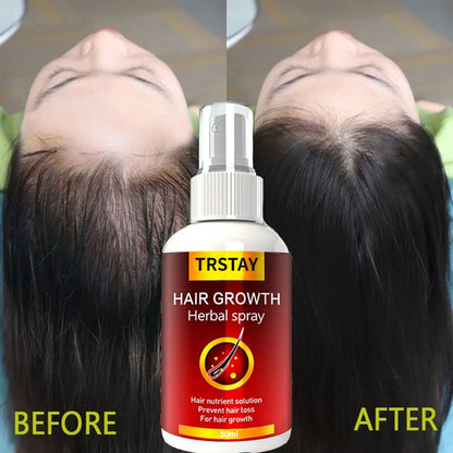 Natural Anti-Hair Loss Treatment for Scalp and Follicles
